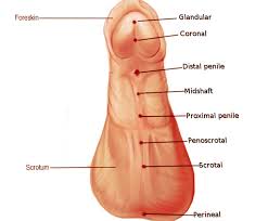 Hypospadias penis